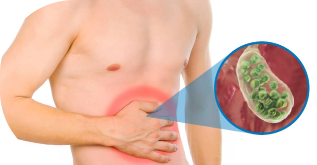 persona con dolor abdominal